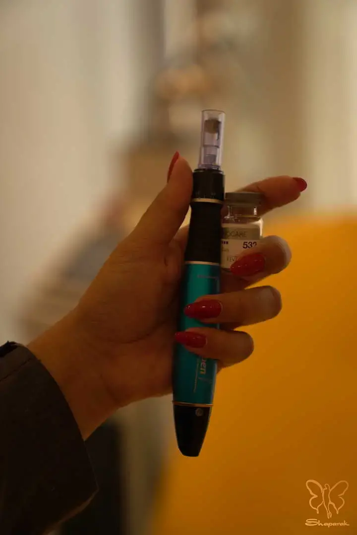 میکرونیدلینگ بازسازی پوست با هزاران سوزن ظریف در کلینیک شاپرک طلایی میکرونیدلینگ بازسازی پوست با هزاران سوزن ظریف در کلینیک شاپرک طلایی