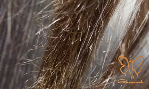 موخوره Split Ends موخوره Split Ends
