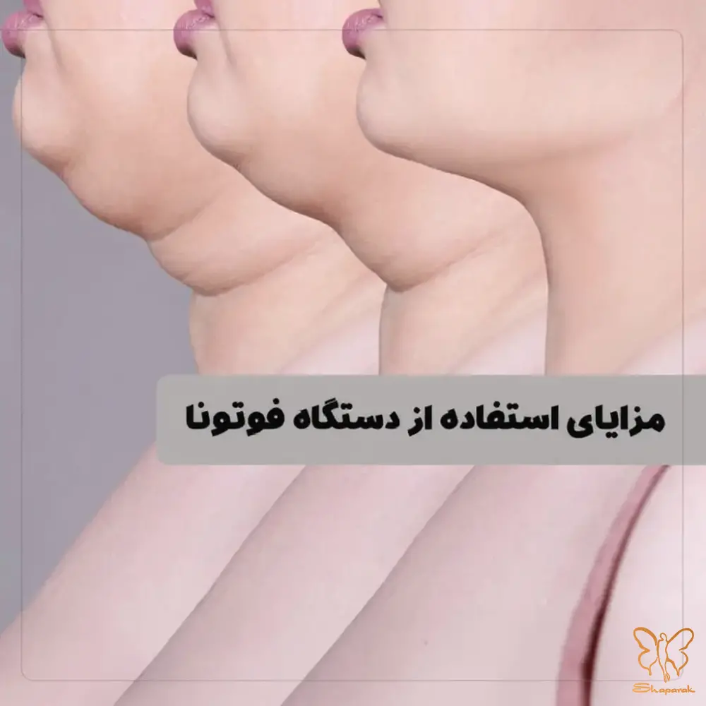 مزو بایواستتیک Meso BioAesthetic چربیسوز
