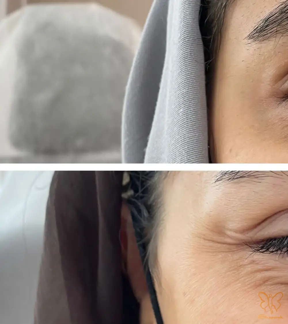 خطوط پنجه کلاغی