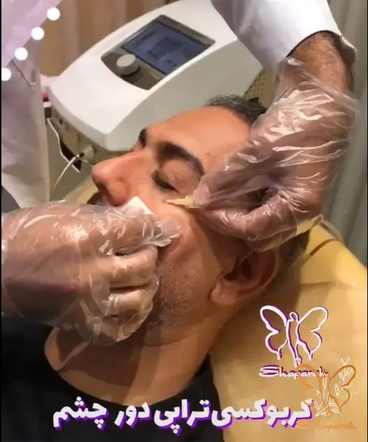 جوانسازی و ترمیم پوست با کربوکسی تراپی