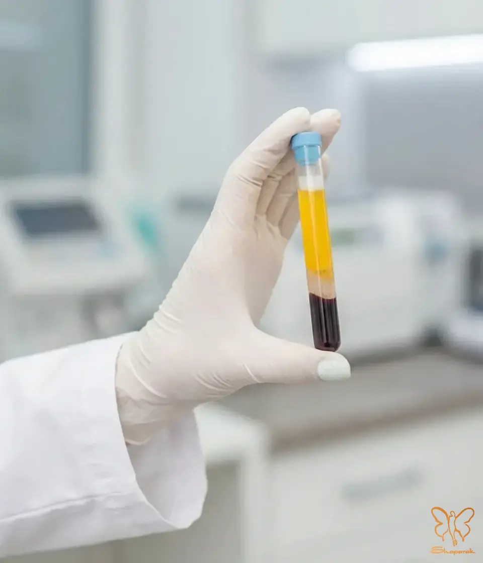 مراقبتهای ضروری پس از تزریق PRP مراقبتهای ضروری پس از تزریق PRP