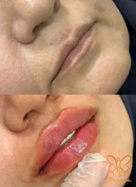 دلیل اعتماد به شاپرک طلایی تخصص اصالت و تجربه