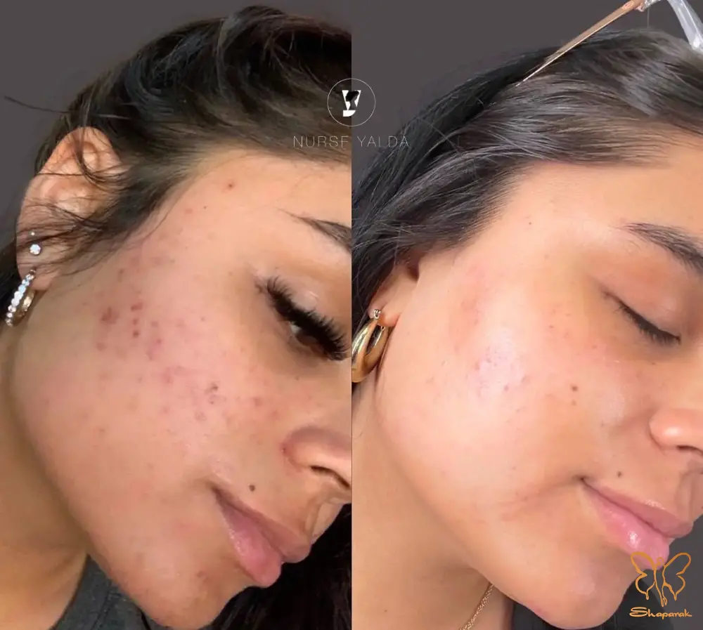 انواع مشکلات پوستی انواع مشکلات پوستی