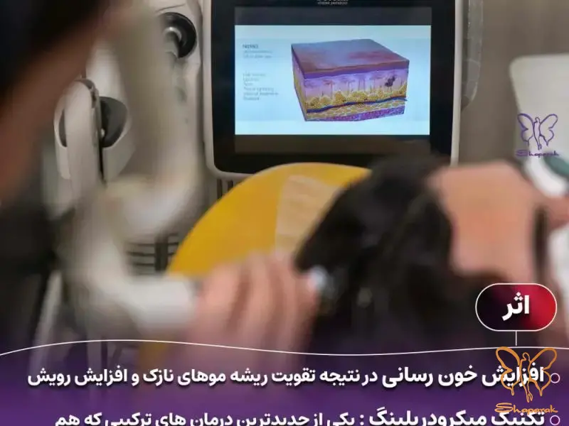 بهترین مسیر درمان رشد مو برای شما چیست