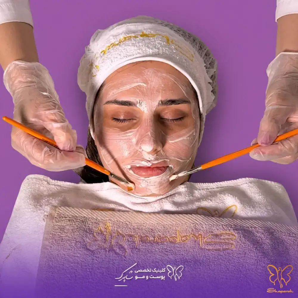 پاکسازی تخصصی صورت