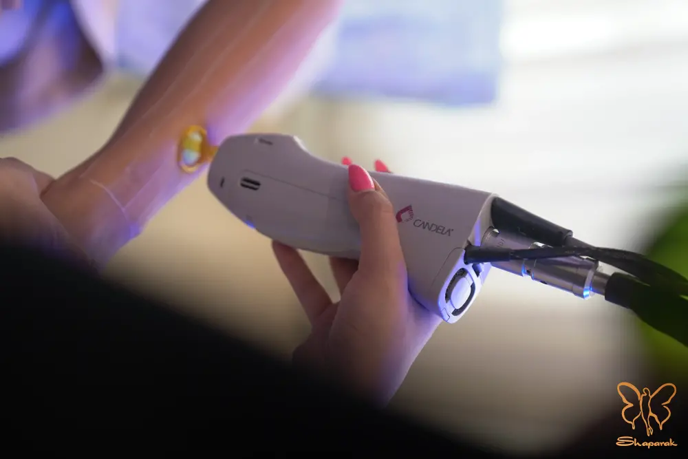 رفع موی زائد مشهد در افراد با پوستهای روشن رفع موی زائد مشهد در افراد با پوستهای روشن