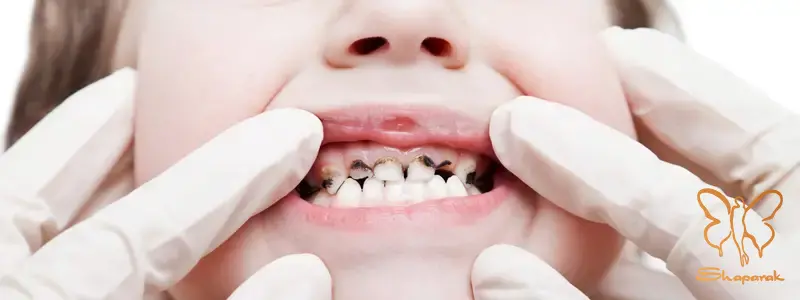 چه عواملی باعث خرابی دندان ها می شوند چه عواملی باعث خرابی دندان ها می شوند