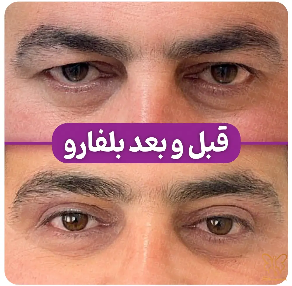 ماندگاری طولانیمدت