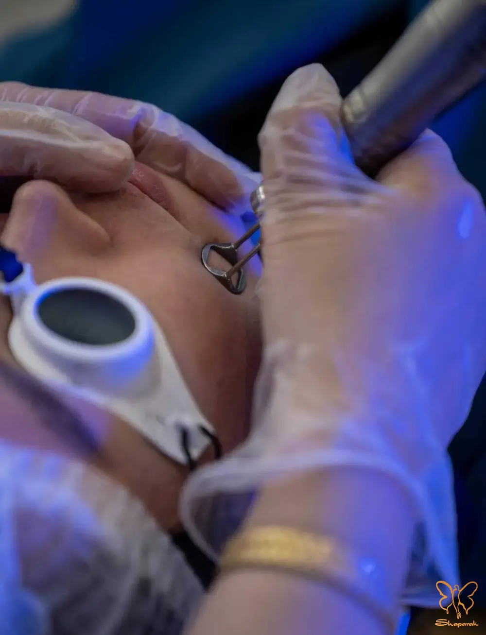 کلاژن و الاستین جدید