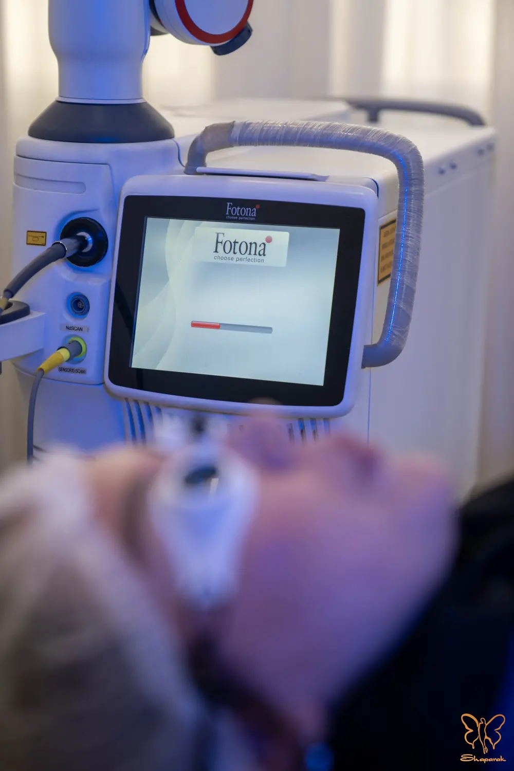 پی آر پی صورت در مشهد پی آر پی صورت در مشهد