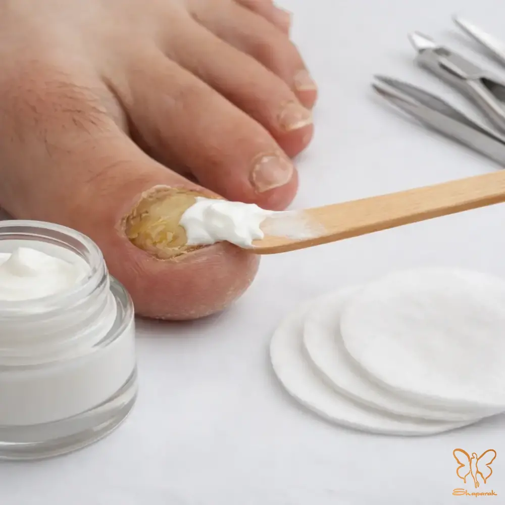 درمانهای دارویی خوراکی و موضعی درمانهای دارویی خوراکی و موضعی