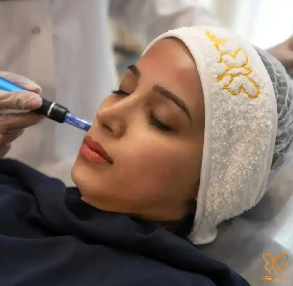 مزونیدلینگ در مشهد