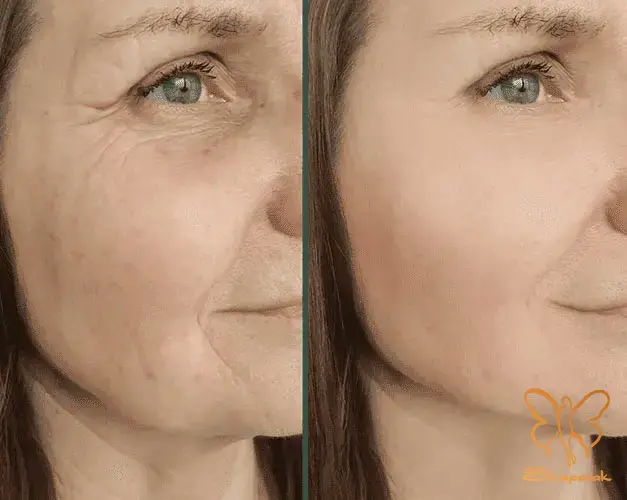 متخصص پوست کلینیک تخصصی لیزر موهای زائد شاپرک طلایی مشهد متخصص پوست کلینیک تخصصی لیزر موهای زائد شاپرک طلایی مشهد