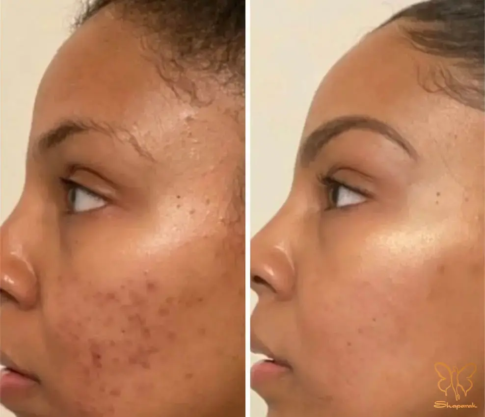 کلینیک تخصصی لیزر موهای زائد شاپرک طلایی در مشهد کلینیک تخصصی لیزر موهای زائد شاپرک طلایی در مشهد