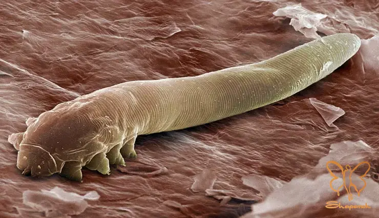 آیا دمودکس به ژنتیک سن و جنسیت ارتباط دارد