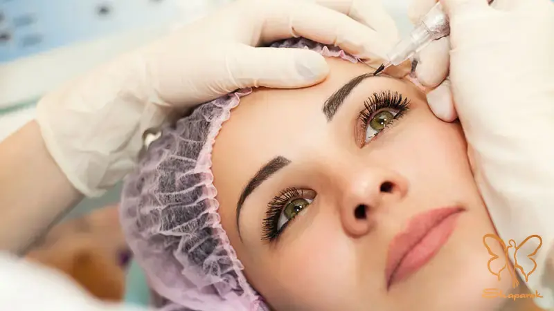 آراف فرکشنال RF در مشهد آراف فرکشنال RF در مشهد