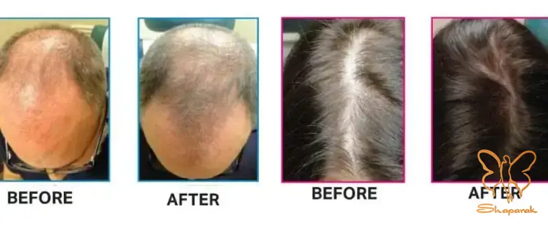 الگوی شماره هفت