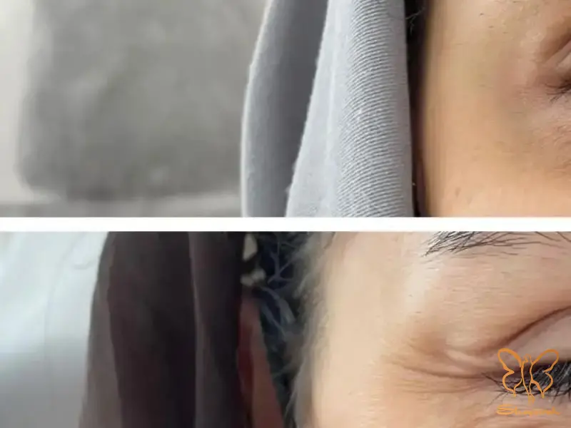 کلینیک تخصصی لیزر و پوست و مو شاپرک طلایی مشهد
