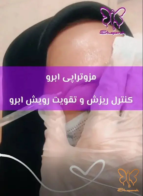 مزوتراپی در مشهد یک روش مؤثر برای درمان ریزش ابرو