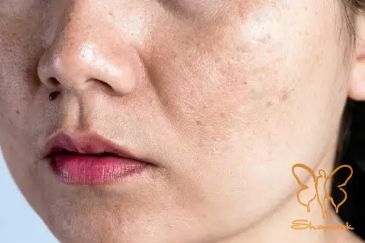 مرطوب کننده ها Moisturizers محافظت و قفل کردن رطوبت پوست مرطوب کننده ها Moisturizers محافظت و قفل کردن رطوبت پوست