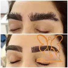 اصلاح بعد از کاشت ابرو به چه صورت است اصلاح بعد از کاشت ابرو به چه صورت است