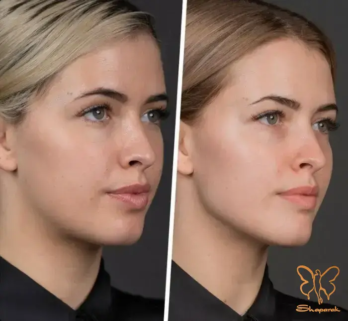 آنتی اکسیدان