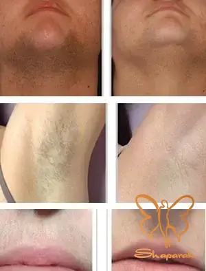 الکساندرایت موتوس در مشهد Motus الکساندرایت موتوس در مشهد Motus