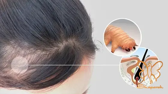  پوست های چرب