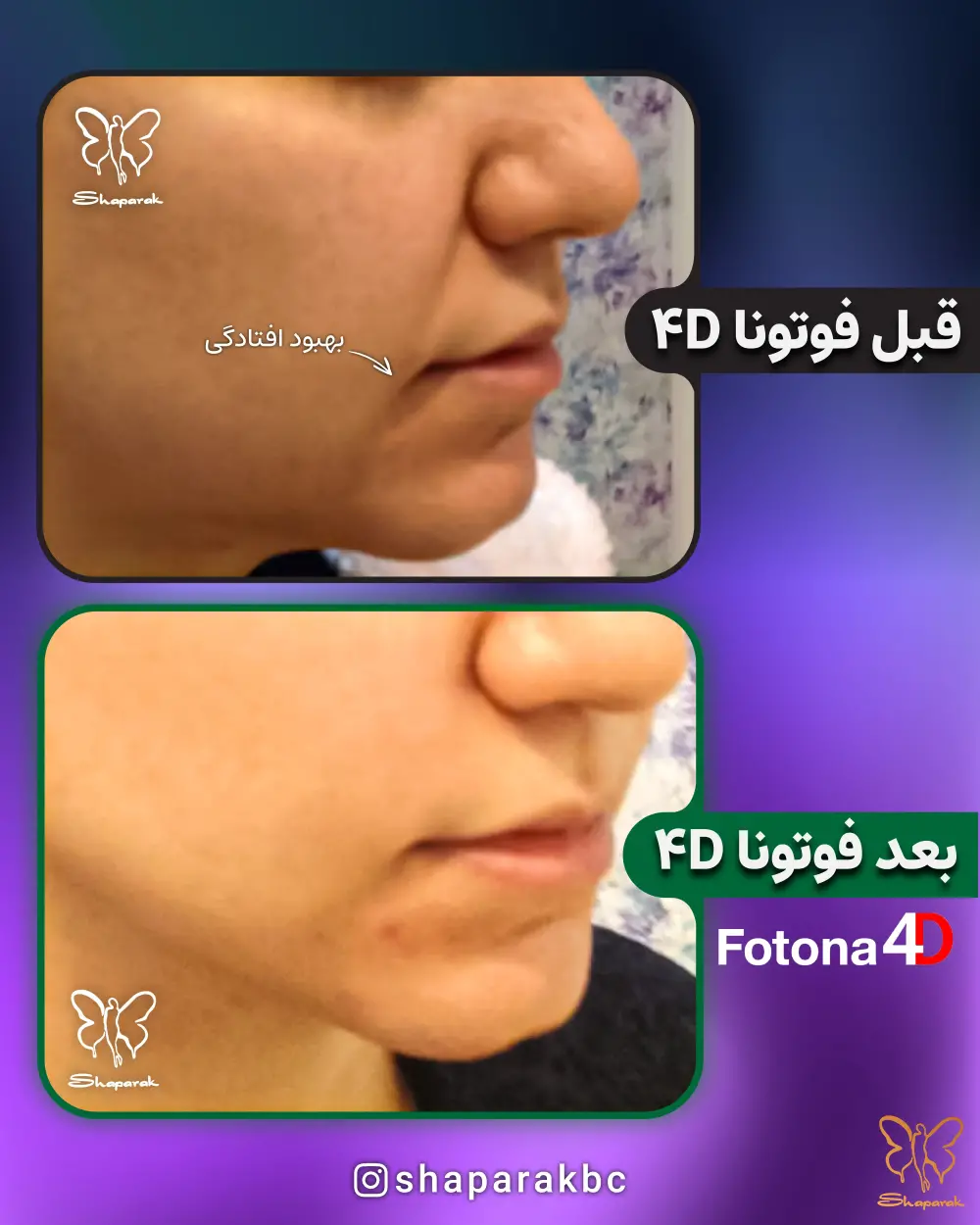 کلینیک تخصصی پوست و مو شاپرک طلایی مشهد