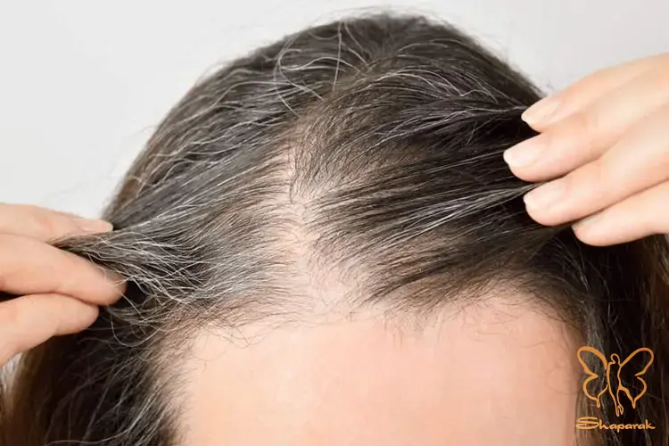 علائم کمبود کراتین در بدن چیست علائم کمبود کراتین در بدن چیست