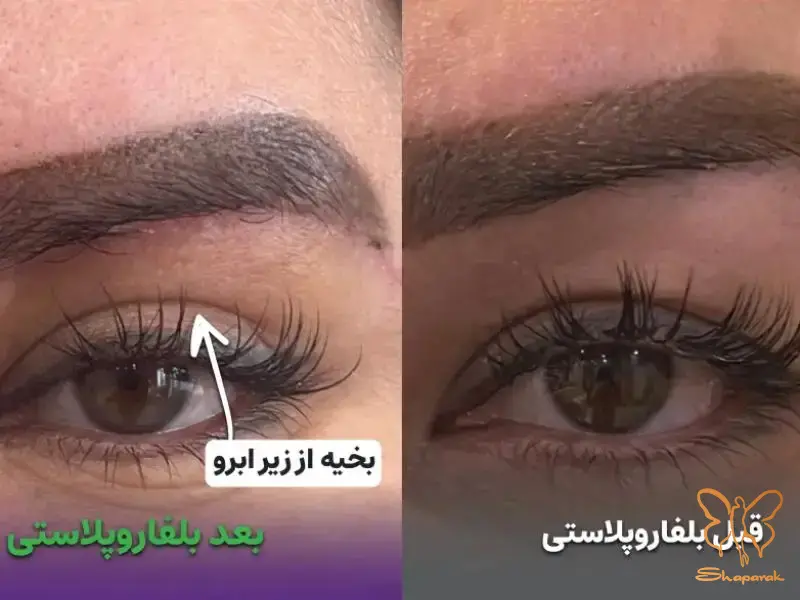 کلینیک تخصصی لیزر و پوست و مو&nbsp;شاپرک طلایی مشهد