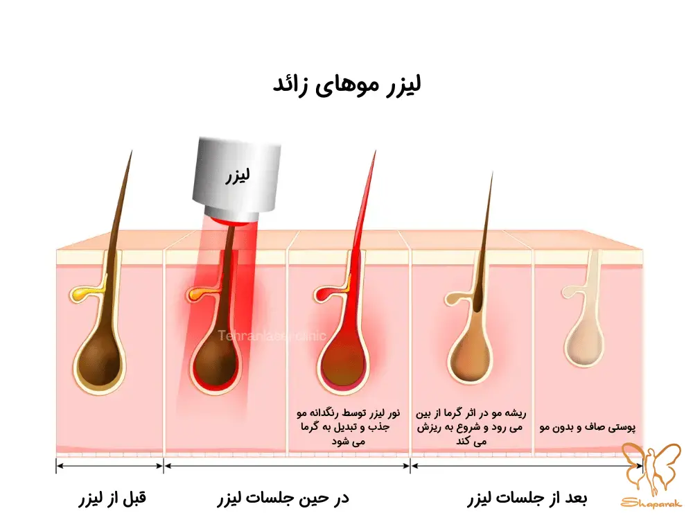 چرخه رشد مو چرخه رشد مو