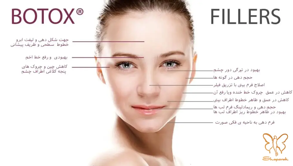 ژل صورت یا فیلر پوستی چیست تفاوتها در کلینیک شاپرک طلایی مشهد
