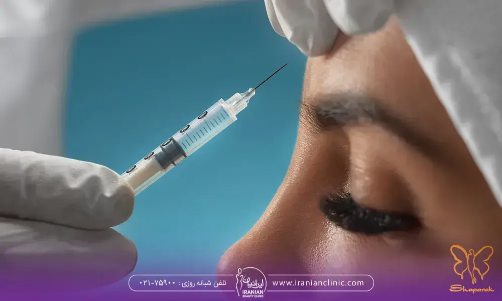 فیلر