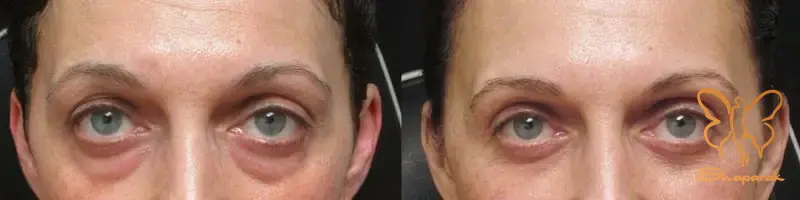  کلینیک تخصصی پوست و مو شاپرک طلایی مشهد