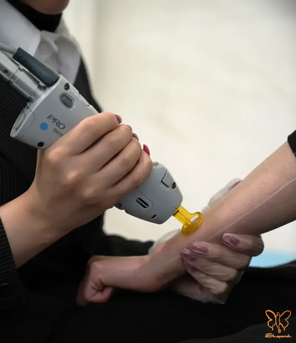 لیزر موهای زائد در مشهد لیزر موهای زائد در مشهد