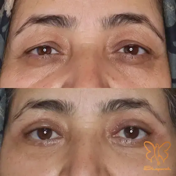 ویتامین C