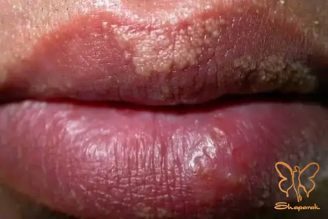  کلینیک تخصصی پوست و مو شاپرک طلایی مشهد