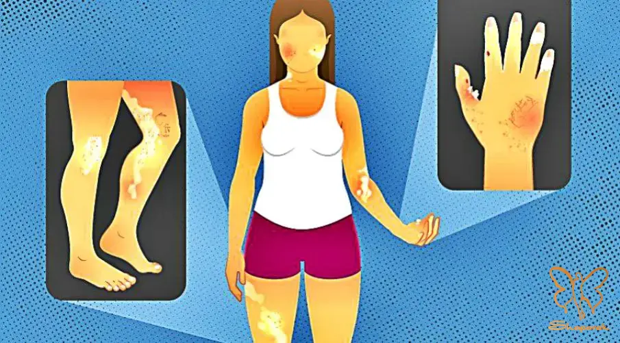 کلینیک تخصصی پوست و مو شاپرک طلایی مشهد کلینیک تخصصی پوست و مو شاپرک طلایی مشهد