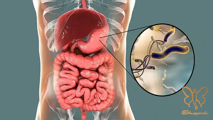 میکروب معده هلیکوباکتر پیلوری دشمن خاموش سلامت و زیبایی شما میکروب معده هلیکوباکتر پیلوری دشمن خاموش سلامت و زیبایی شما
