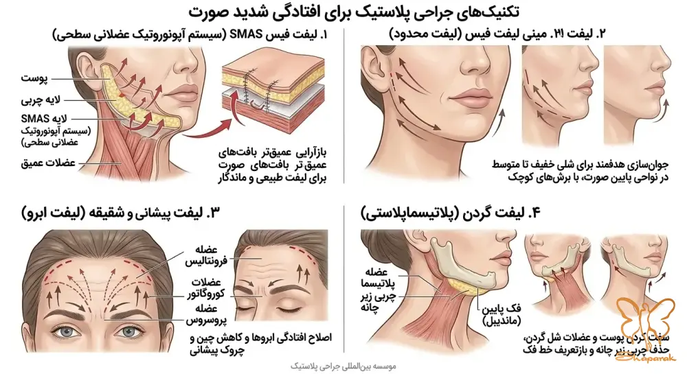 ۴ لیفت گردن Neck Lift