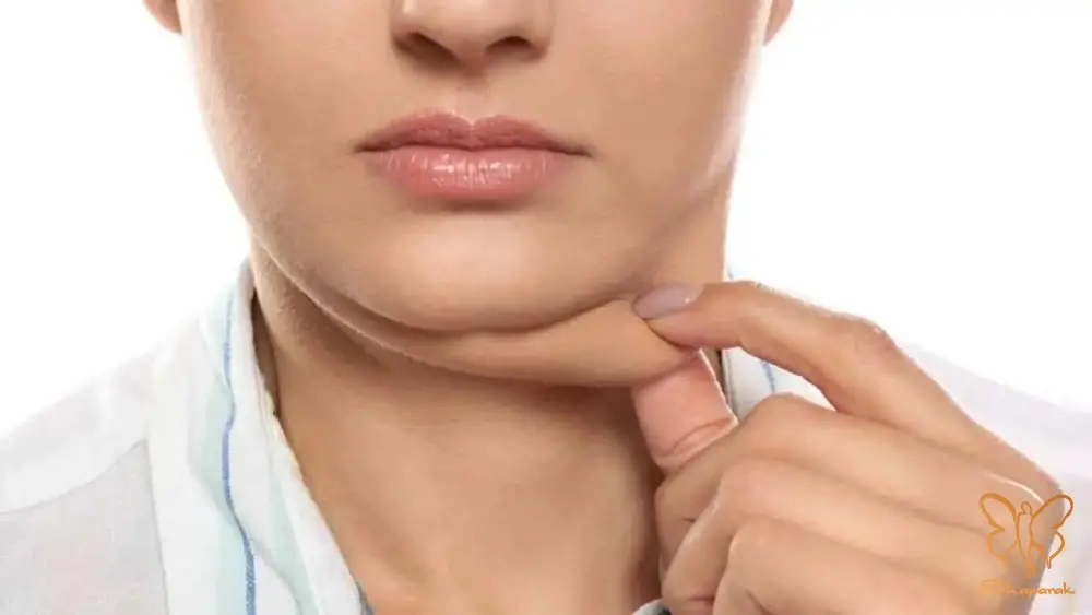 چه کسانی کاندیدای ایدهآل برایهر روش رفع غبغب هستند