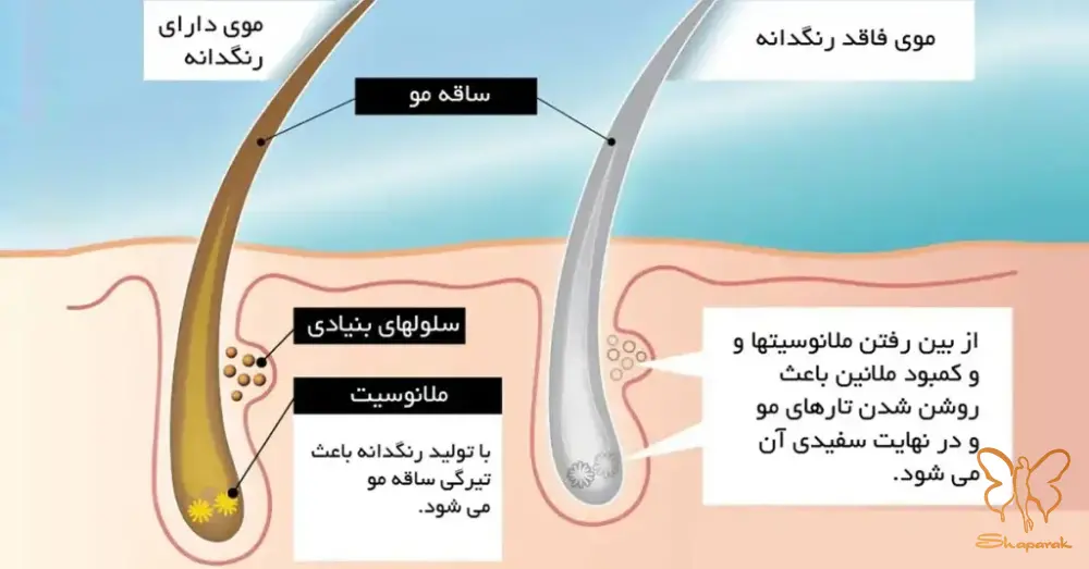 درماتیت سبورئیک درماتیت سبورئیک