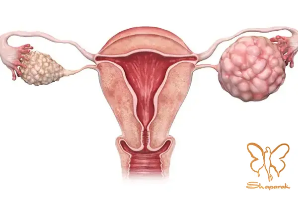 وقتی تیروئید کمکار یا پرکار میشود وقتی تیروئید کمکار یا پرکار میشود