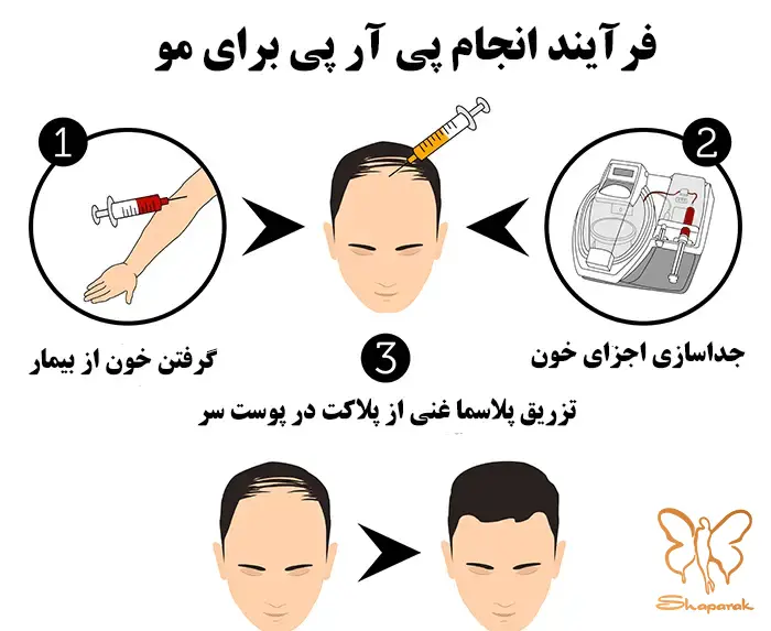  کلینیک تخصصی پوست و مو شاپرک طلایی مشهد