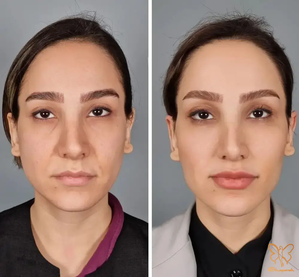 پیری پوست پیری پوست