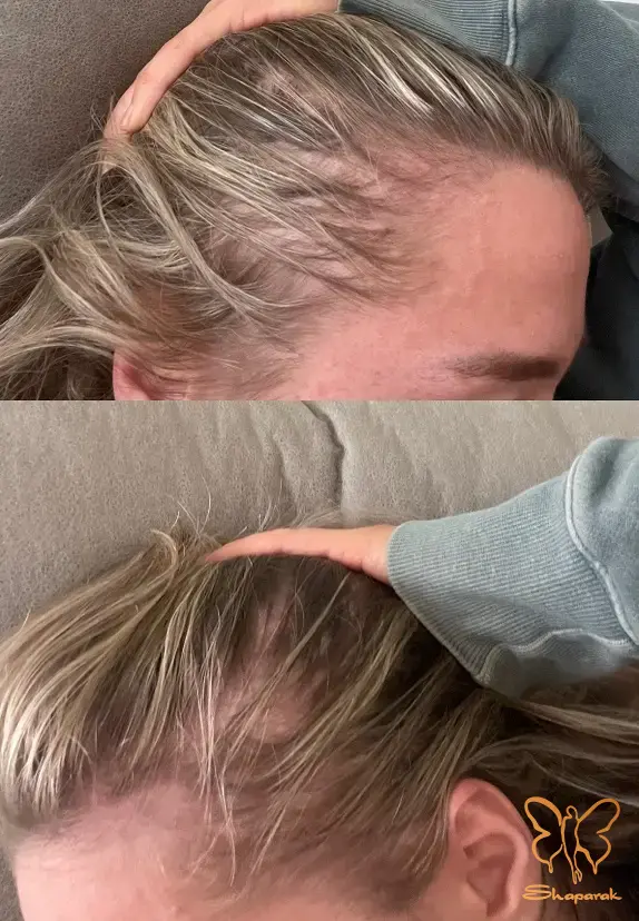 آنتی اکسیدان ها آنتی اکسیدان ها