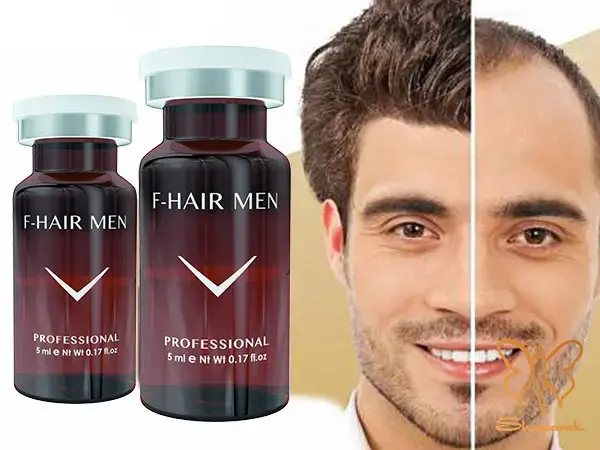 چرا فیوژن در مشهد پرطرفدار است چرا فیوژن در مشهد پرطرفدار است