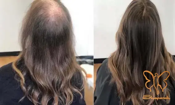 کلینیک شاپرک طلایی مشهد کلینیک شاپرک طلایی مشهد